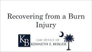 Recovering from a Burn Injury in SC | Burn Injury Resources | Law Office of Kenneth Berger