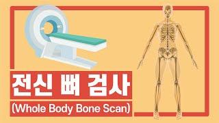 [서울성모병원] 전신 뼈 검사