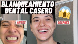 BLANQUEAMIENTO DENTAL CASERO USANDO POLANIGHT 16% CON PERÓXIDO DE CARBAMIDA // PASO A PASO!!