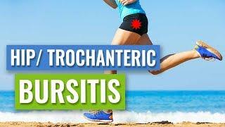 Lateral Hip or Trochanteric Bursitis - Causes and Treatment