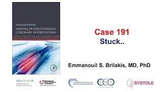 Case 191: Manual of PCI - Stuck...