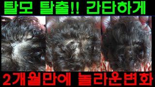 간단하게 탈모에서 벗어나보자