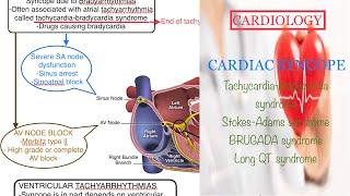 CARDIAC SYNCOPE @Tachycardia bradycardia syndrome@ Stokes adams syndrome@brugada stndrome@long QT sy