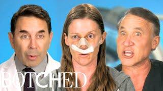 Sara's Son Accidentally Broke Her Nose Because Of Santa Claus?! FULL TRANSFORMATION | Botched | E!