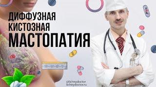 Диффузная кистозная мастопатия: симптомы, лечение и рекомендации