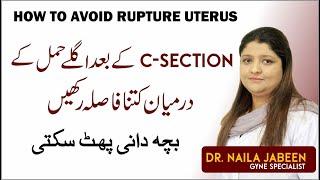 Delivery After C Section | Bacha Dani Phat Jana | Uterus Rupture: Next Pregnancy Gap After C Section