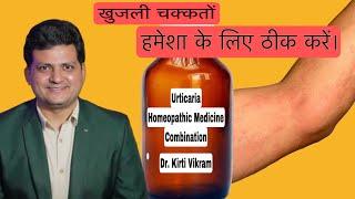 Urticaria Homeopathic Medicine Combination | How to Use | @Drkirtivikramsingh