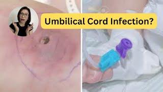 Is it an Umbilical Cord Infection? | Dr. Kristine Alba Kiat