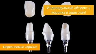 Коронка и абатмент в одном проекте. Моделировка зубов. Резец. Экзокад. Exocadю