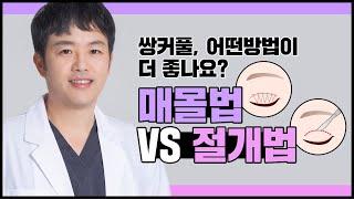 [닥터뷰티의원] 쌍꺼풀수술 매몰법, 절개법 어떤 방법을 선택해야 할까?