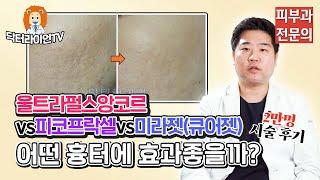 울트라펄스앙코르피코프락셀미라젯(큐어젯) 어떤 흉터에 효과 좋을까20,000명 시술 후기