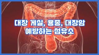 대장 게실, 용종, 대장암 예방하는 섬유소 : 차전자피 화이버의 장점