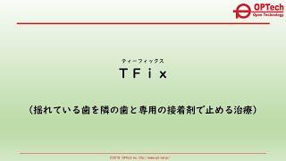 ＴＦｉｘ