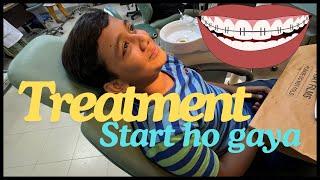 Finally Muhammad Ka Treatment Start Ho Gaya   #teeth #braces #treatment @madeehafaisal