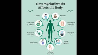 Homeopathy For Myelofibrosis #trendingreels  #leukemiaawareness  #leukemiasurvivor  #leukemia