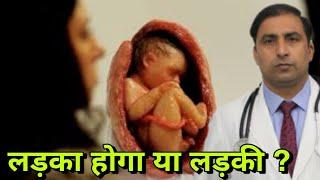 लड़का होगा या लड़की जानिए कैसे तय होता है ? Will it be a boy or girl / Dr Kumar education clinic