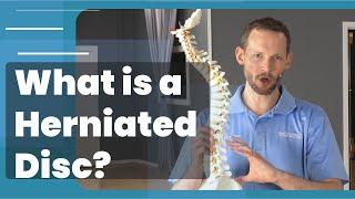 What Is A Herniated Disc - Symptoms, Causes, Treatments