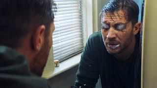 Venom Scares Eddie Scene - Venom (2018) Movie Clip HD