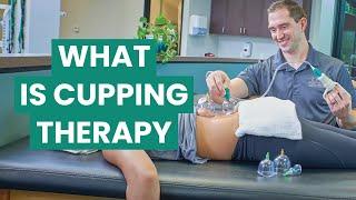 What is Cupping Therapy? Types, Benefits, and Treatment | Foothills Sports Medicine Physical Therapy