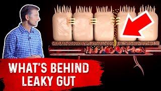 What's Really Behind Leaky Gut? – Dr.Berg On Leaky Gut Symptoms  & Vitamin C Deficiency