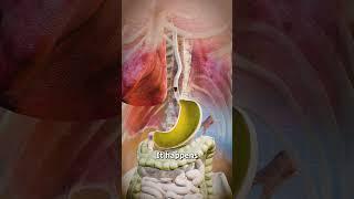 Acid Reflux Explained 