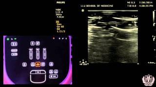 How to use Any Ultrasound Machine - Knobology and Physics - Made Super Simple
