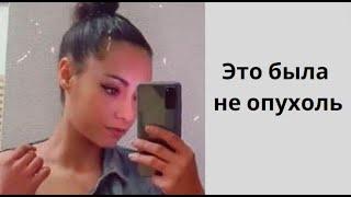 2 года лечили химиотерапией губку