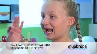 G3 Swallowing   Correct Swallow