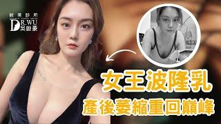 【女王波隆乳成果】產後媽媽給自己的禮物，產後萎縮掰掰 ! 最新隆乳案例紀錄 ! ｜峻美診所｜吳峻豪｜