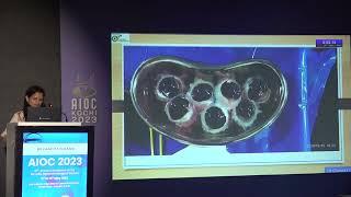 AIOC 2023   IC58   topic Dr  CHARUTA PURANIK Donor Cornea Convalescence Program