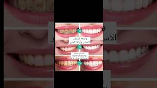 The most powerful recipe for removing tooth yellowing | وصفه لإزالة  إصفرار الاسنان