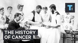 The history of cancer