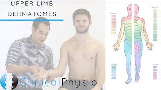 Upper Limb Dermatomes | Clinical Physio