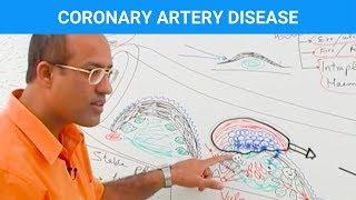 Coronary Artery Disease | Ischemic Heart Disease | Angina🫀