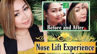 NAG PATANGOS NG ILONG | MY NOSE LIFT EXPERIENCE | REVIEW