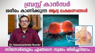 ബ്രസ്റ്റ് കാൻസർ ശരീരം കാണിക്കുന്ന ആദ്യ ലക്ഷണങ്ങൾ | Breast Cancer Malayalam