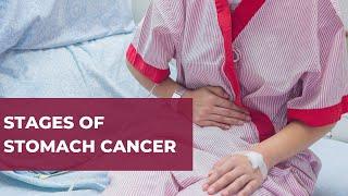 What Are The Stages Of Stomach Cancer? | Ask A Gut Doctor