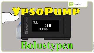 YpsoPump Verschiedene Bolustypen Insulinpumpe mylife Diabetescare 07