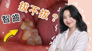 「還有智齒的必看」拔完臉會變小嗎？牙齒變擁擠？超級痛！打破智齒迷思 @DrTeresa