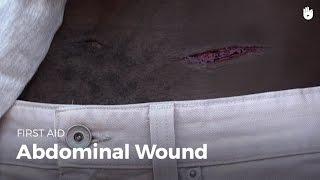 Learn first aid gestures: Abdominal Wound