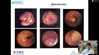 Рак толстого кишечника Клиника Диагностика