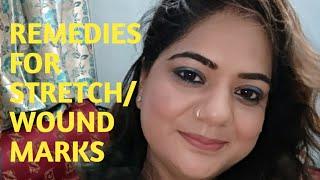 #HOME REMEDIES#FOR#WOUND#STRETCH MARKS#Nancy The Makeup Artist!!!!!