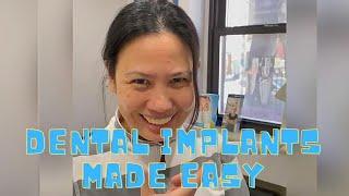 Happy Patient Review after Dental Implants! | Dental Made Easy