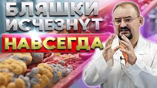 The plaques will dissolve! The whole TRUTH about Atherosclerosis