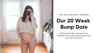 20 Week Bump date | The Wild Decoeli's