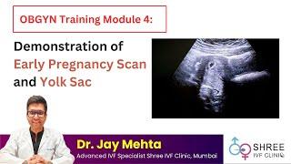 OBGYN Training Module 4: Demonstration of Early Pregnancy Scan and Yolk Sac | Dr Jay Mehta