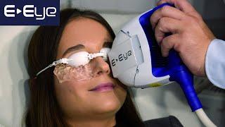 E-EYE treatment