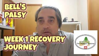 BELL'S PALSY | WEEK 1 RECOVERY JOURNEY