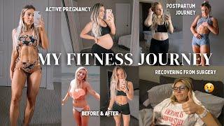 my fitness journey | getting fit, pregnancy, postpartum & recovering from surgery