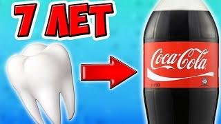The tooth has been in Coca Cola for 7 years